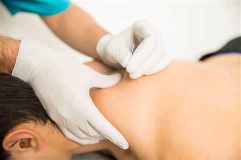 What Training Do The Acupuncturists Have At Modern Acupuncture