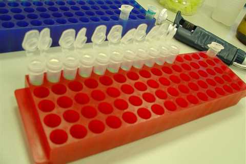 Autoimmune Biotech Vor Bio Secures $175M for Phase 3 Asset